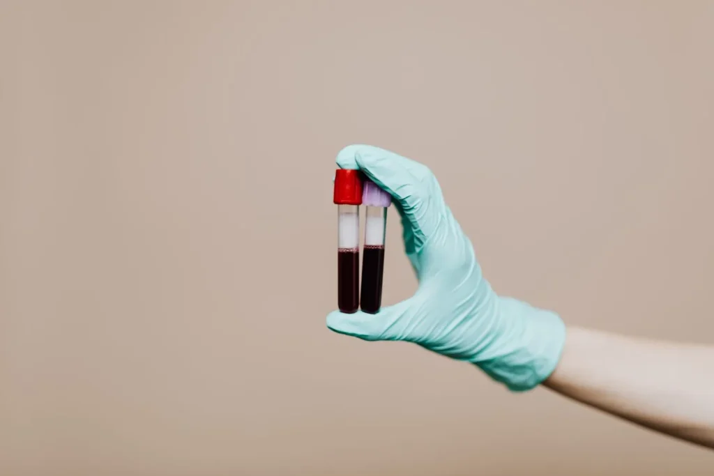 Collector holding sealed specimen tubes during a mobile visit