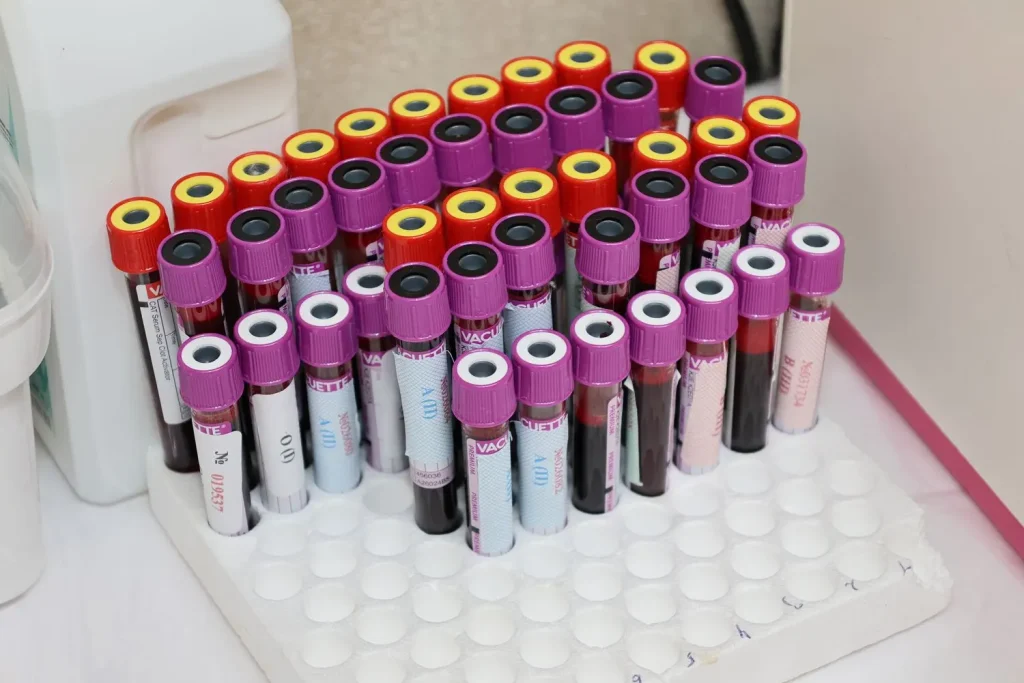 Collected specimens logged in at the laboratory for analysis